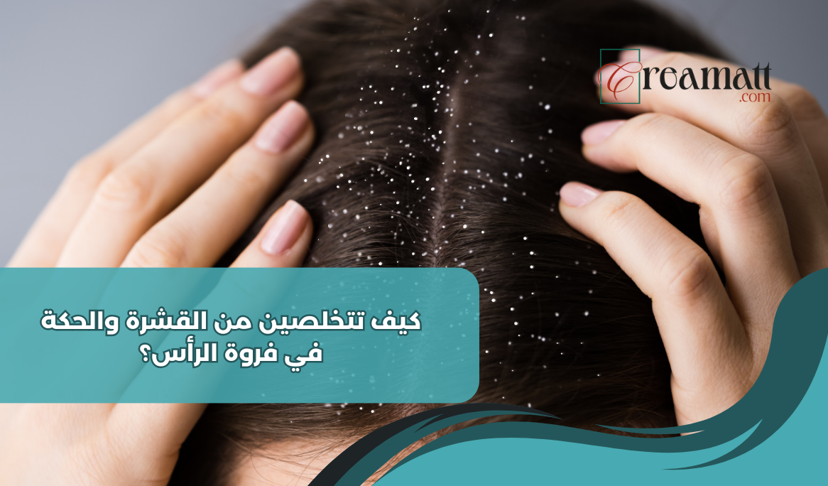 كيف تتخلصين من القشرة والحكة في فروة الرأس؟