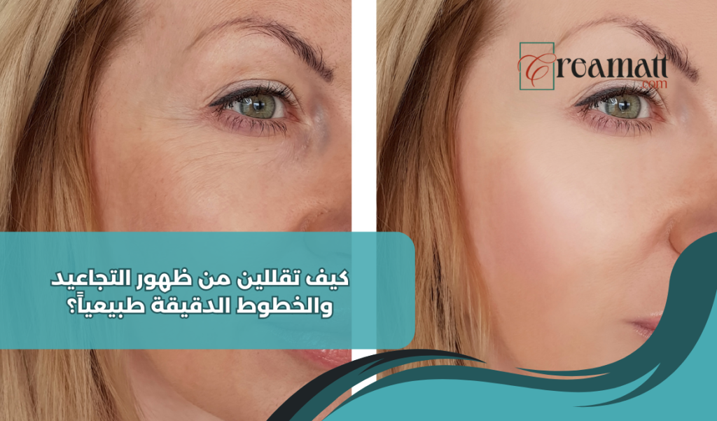 كيف تقللين من ظهور التجاعيد والخطوط الدقيقة طبيعياً؟