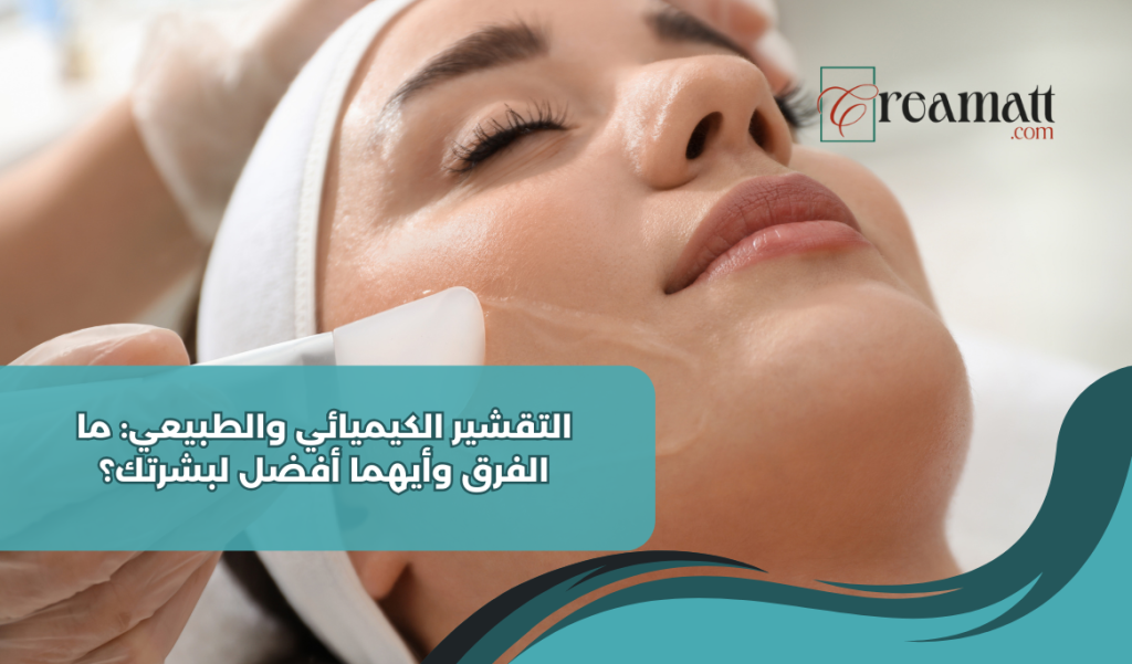 التقشير الكيميائي