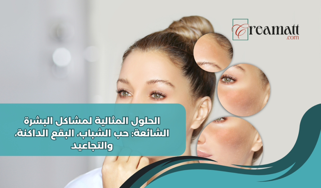 مشاكل البشرة