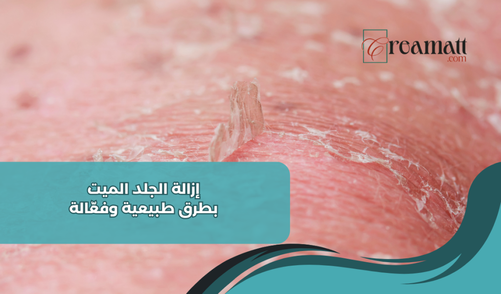 إزالة الجلد الميت