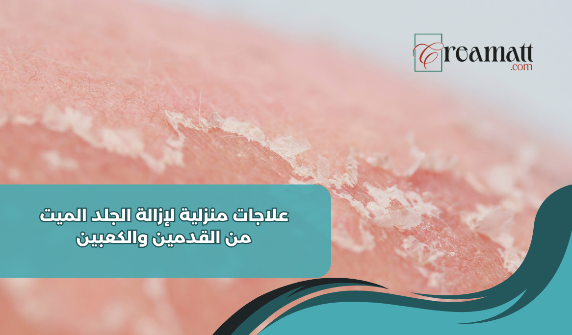 الجلد الميت